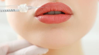Lip Injections: Enhance Your Pout With Safe And Effective Cosmetic Procedures