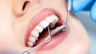 Top Dentist Tips: Maintain Optimal Oral Health Today